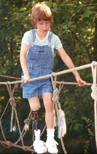 Child with a lower extremity amputation participating in a ropes course.