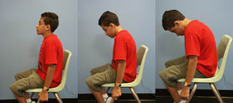 Child with Spina Bifida is performing an Upper Trunk Flexion exercise
